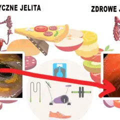 Jak odbudować jelita? 7 skutecznych sposobów na zdrowy mikrobiom