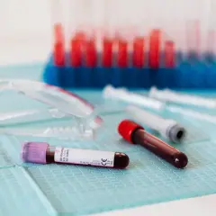 Słaba krzepliwość krwi: niebezpieczne objawy, które musisz znać