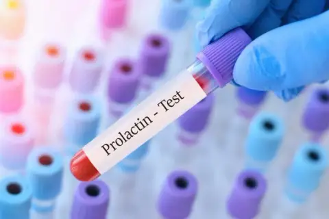 Niska prolaktyna objawy: Niebezpieczne konsekwencje zaburzeń hormonalnych