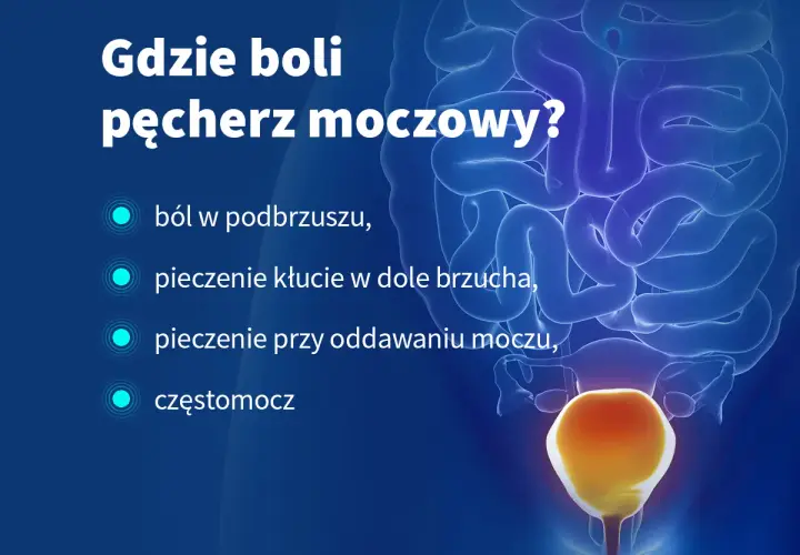 Ostre bóle pęcherza: objawy, które musisz znać i jak je zwalczyć