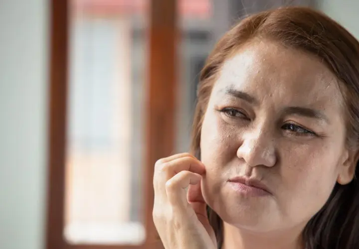 Hemochromatoza: 5 objawów skórnych, które musisz znać
