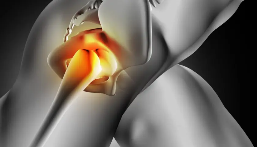 Bolesne zapalenie krętarza biodra: objawy, które musisz znać